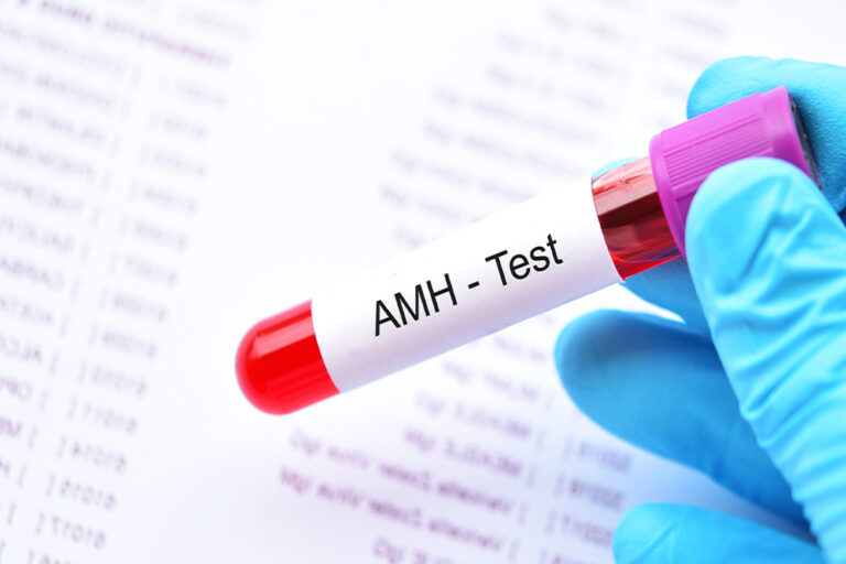 ما هو اختبار AMH